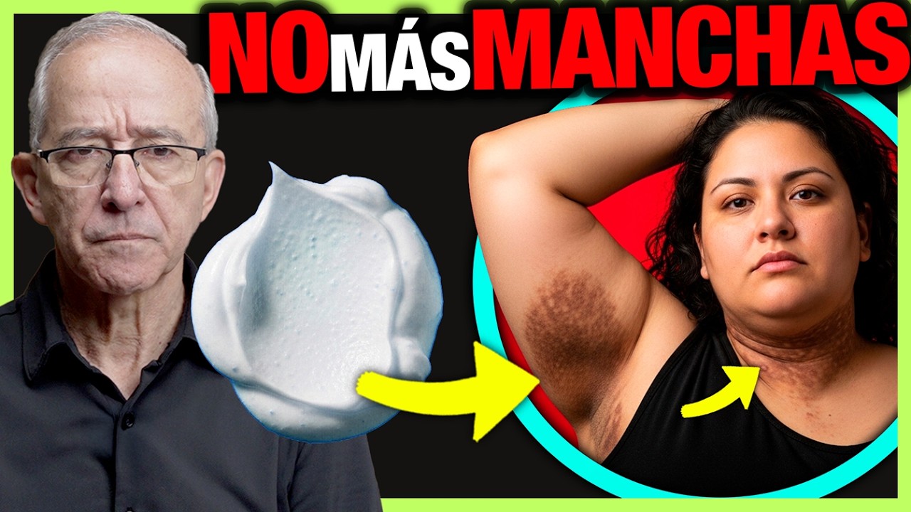 🧼 USA EL BICARBONATO ASI Para Las Manchas En Tu Cuello , Oswaldo Restrepo