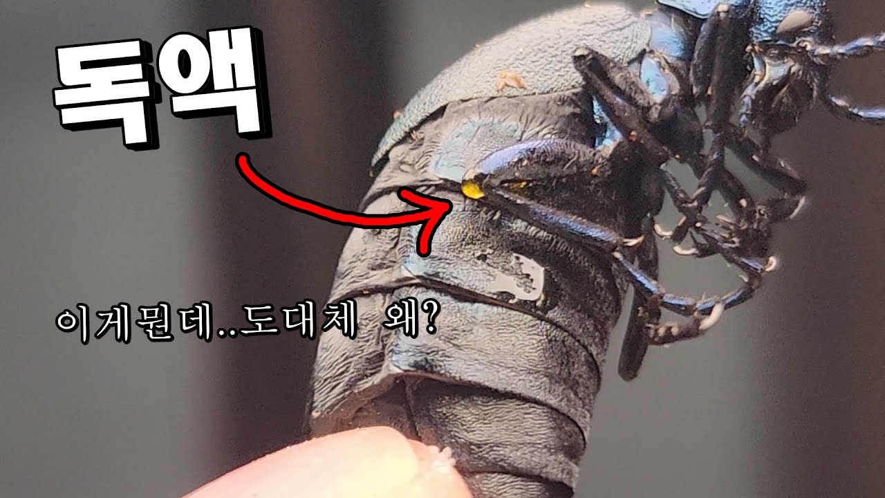 저 노란액체 진짜 조심해야합니다...