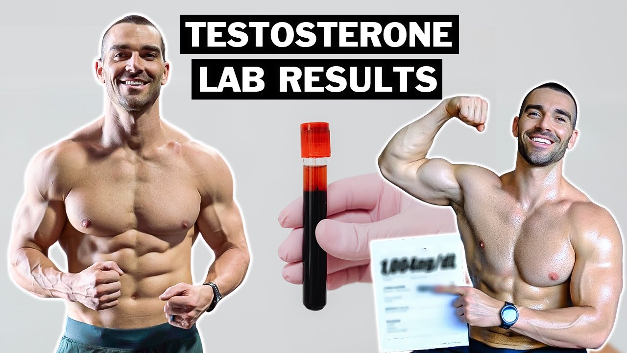 How to Increase Your Testosterone Naturally (5 Tips)