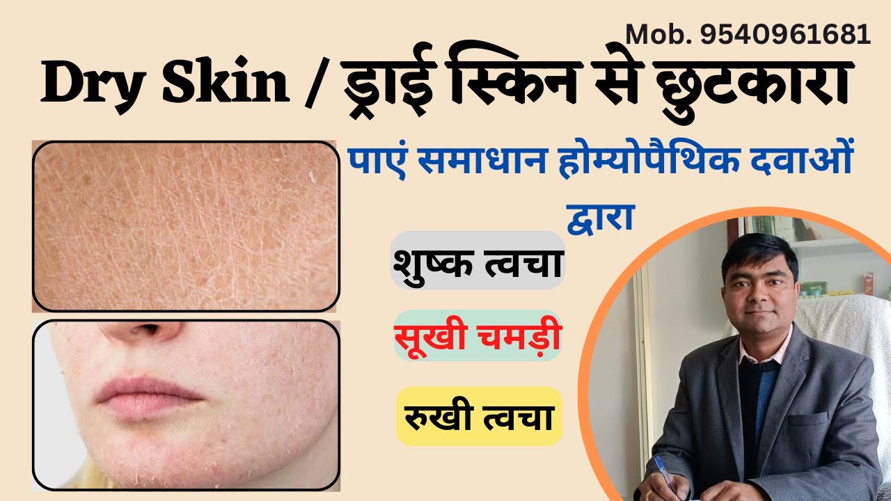 Homeopathic medicine/ treatment for Dry Skin | रुखी त्वचा का होम्योपैथिक इलाज | Skin Problems winter