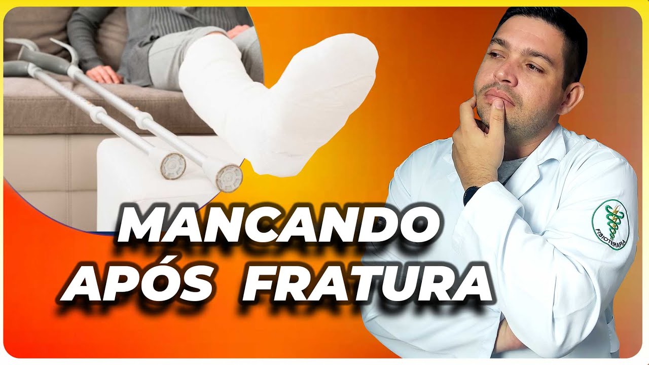 Fui Liberado para Pisar após Fratura de Tíbia mas estou Mancando e agora?