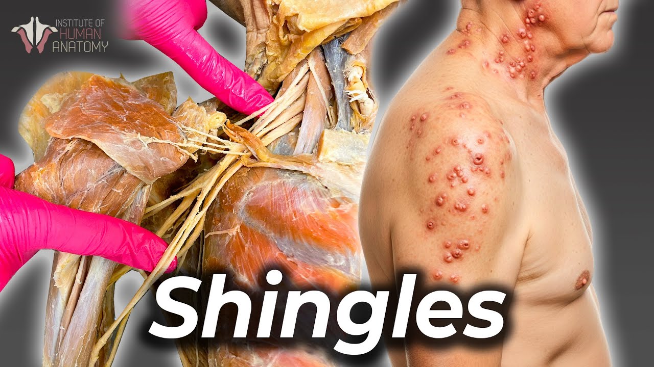 The Virus That Hides In Your Body For 50 Years