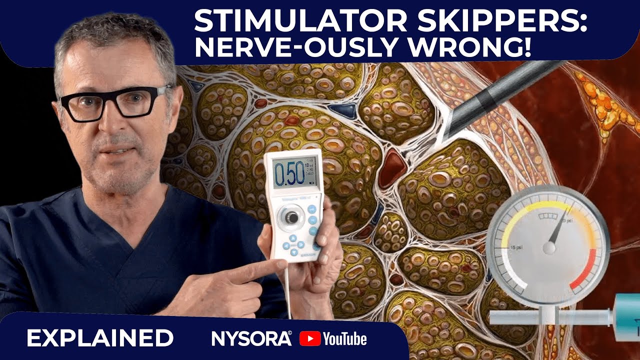 It's Time to Rediscover Your Nerve Stimulator!