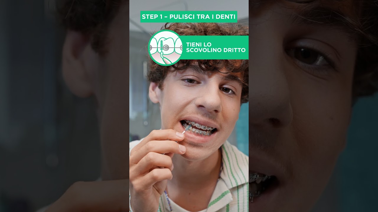 GRWM con l'apparecchio &ndash; Step 1: pulisci tra i denti e intorno agli attacchi - GUM Trav-ler