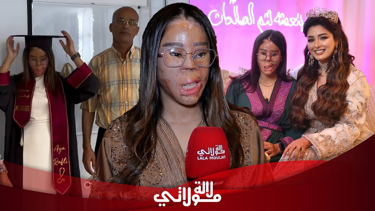 بسبب كثرة العمليات..آية تروي معاناتها/صداقتها بهبة وردها على الاتهامات