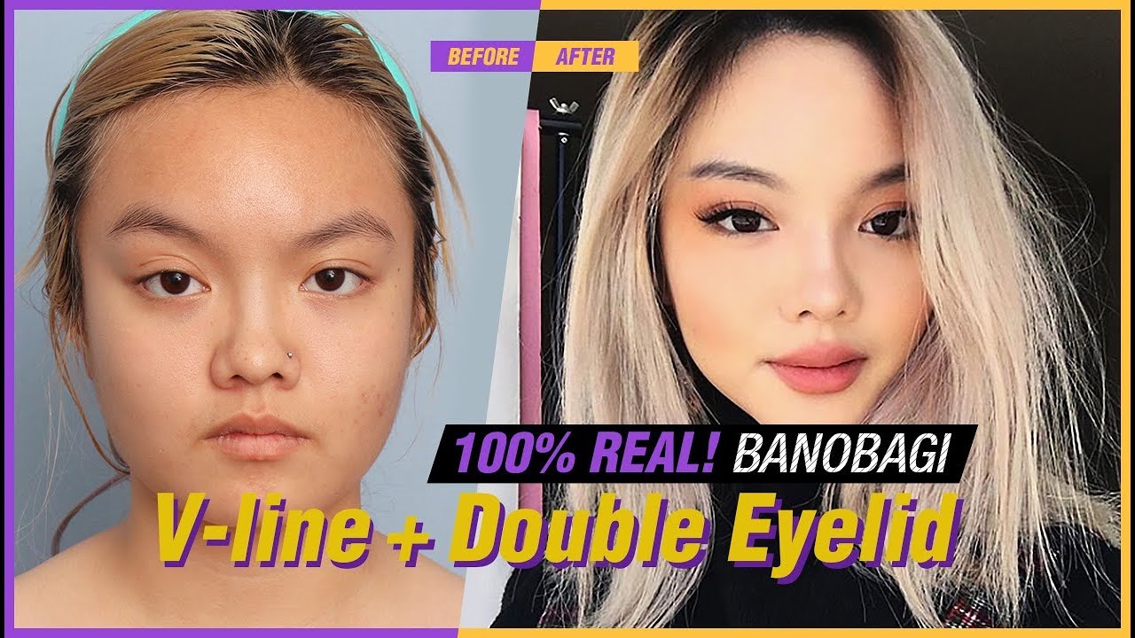 [BANOBAGI] Journey of Plastic Surgery Clinic with 'Jenny Dear'