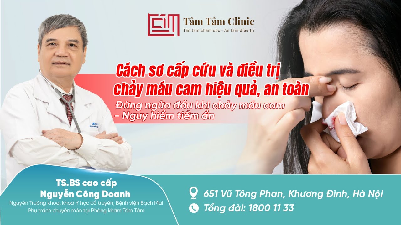 Cầm chảy máu cam nhanh, đúng cách trong 3 phút – Ai cũng nên biết