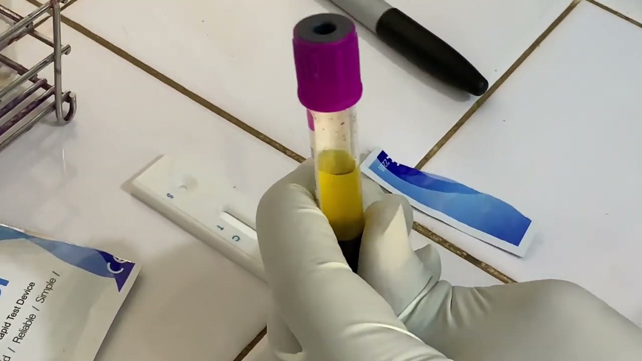 Technique sérologique des infections à Chlamydia trachomatis