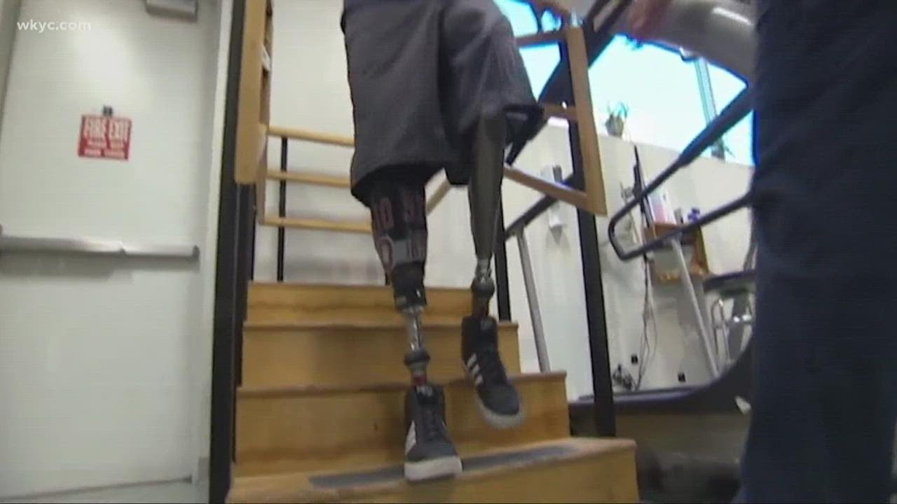 Train accident survivor uplifts others dealing with trauma