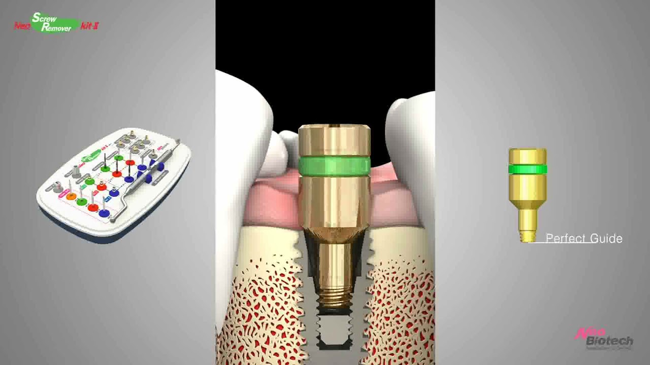 NeoBiotech Screw Remover Kit - How-To Guide