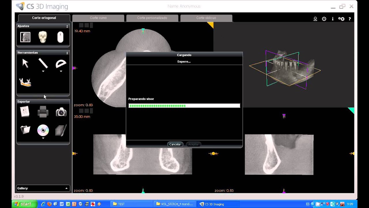 Tutorial CS 3D imaging software. Carestream.02-Carestream. Carga del Volumen.avi