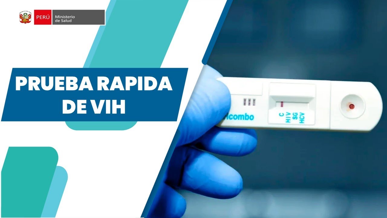 PRUEBA RAPIDA DE VIH
