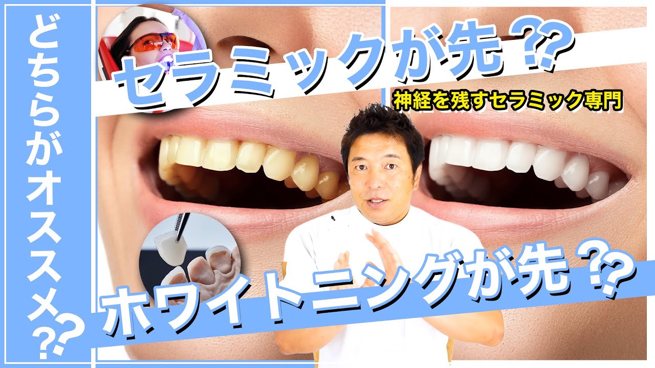 【後悔しないのはどっち？】セラミックが先か？ホワイトニングが先か？