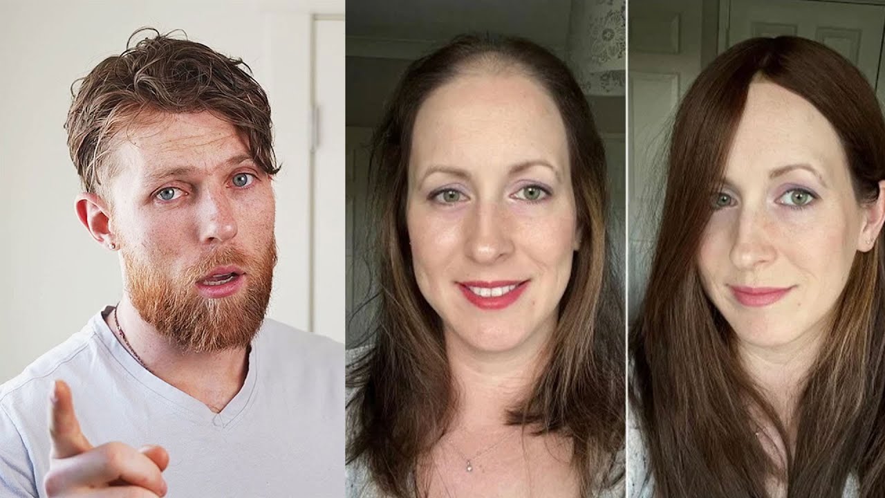 3 Life Changing Female Hair System Transformations