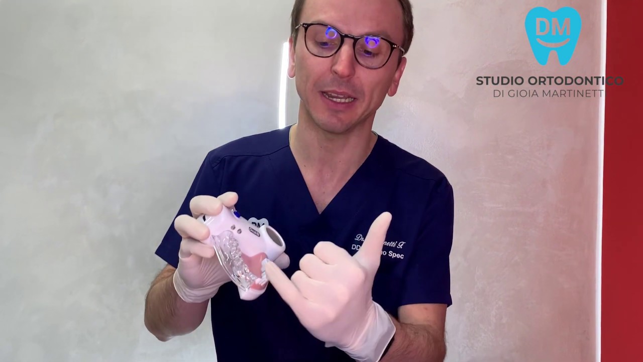 COME SI PASSA IL FILO INTERDENTALE? SCOPRIAMOLO INSIEME A FRANCESCO!