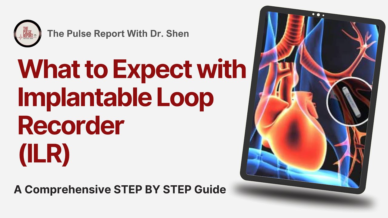 Loop Recorder Implantation Guide for Patients: What to Expect Before, During & After the Procedure