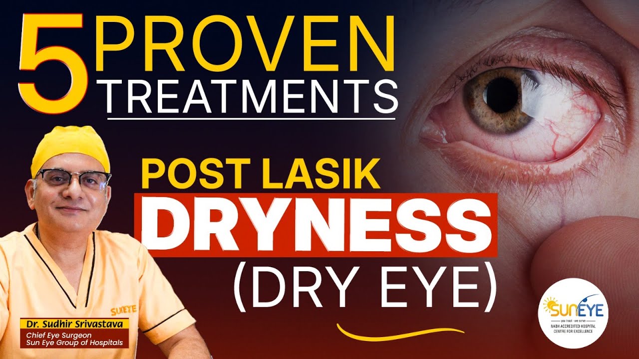 5 Proven treatments of Dry Eye - Post lasik dry eye #suneyecafe #dryeye #lasiksurgery
