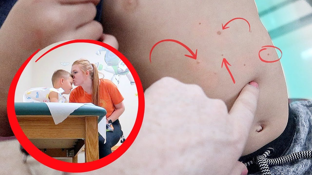 My son developed these ALL over his body… (doctor appointment)