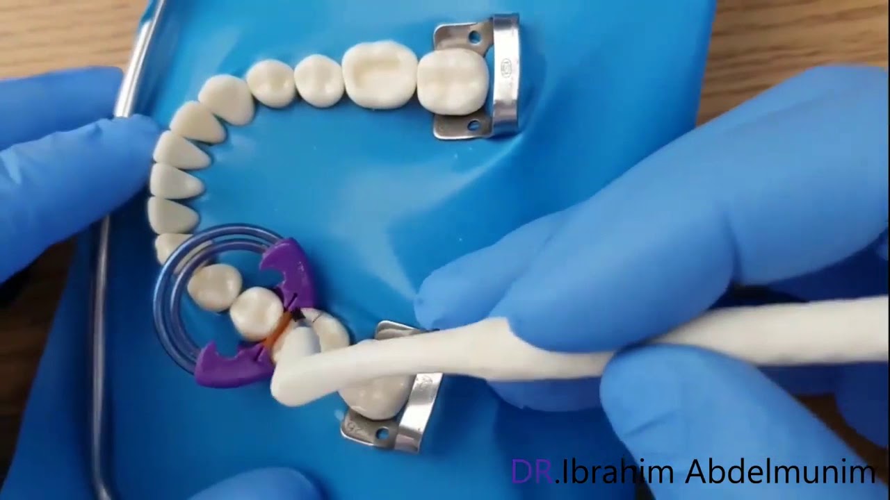 شاهد كيف تصنع الحشوات التجميلية بطريقة صحيحة