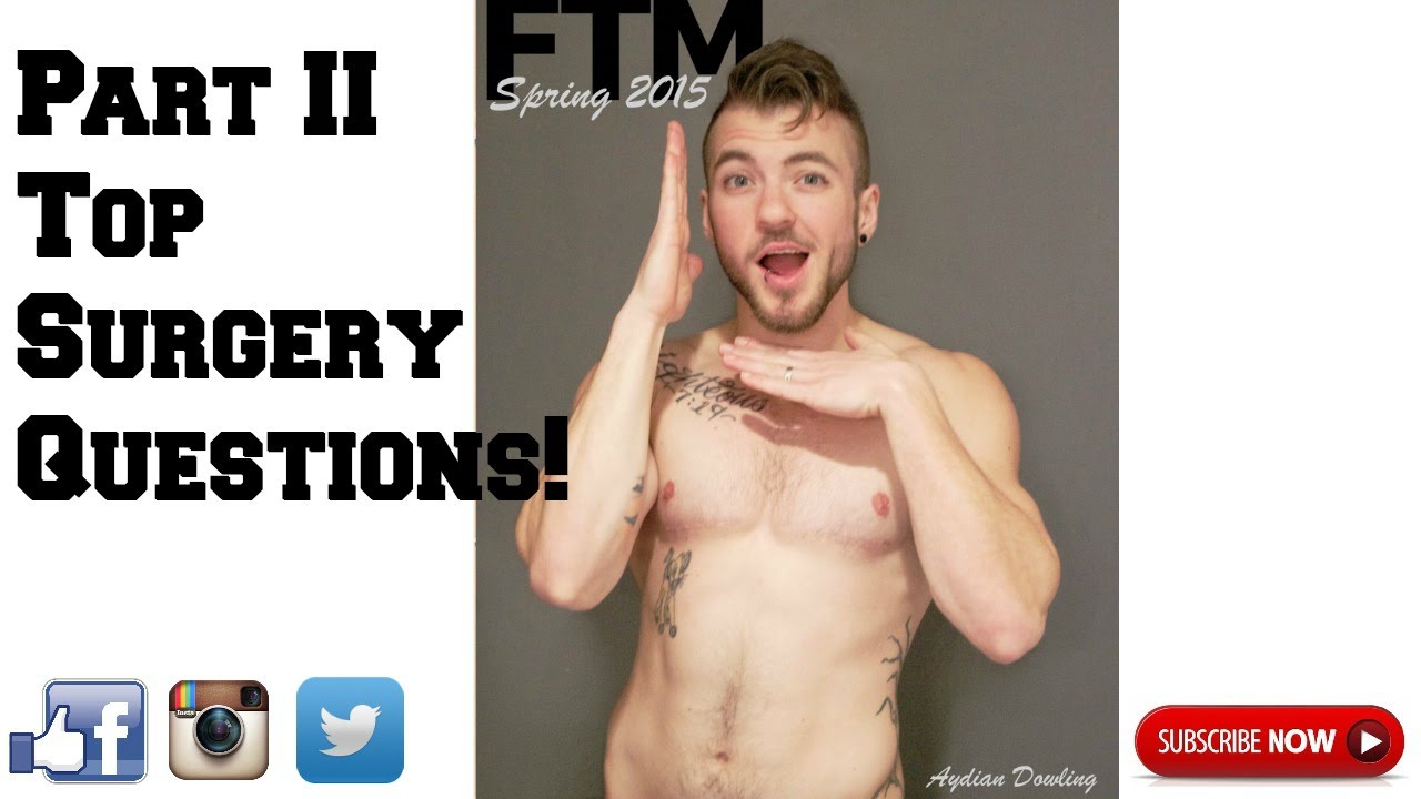 Part II: Top Surgery Questions!