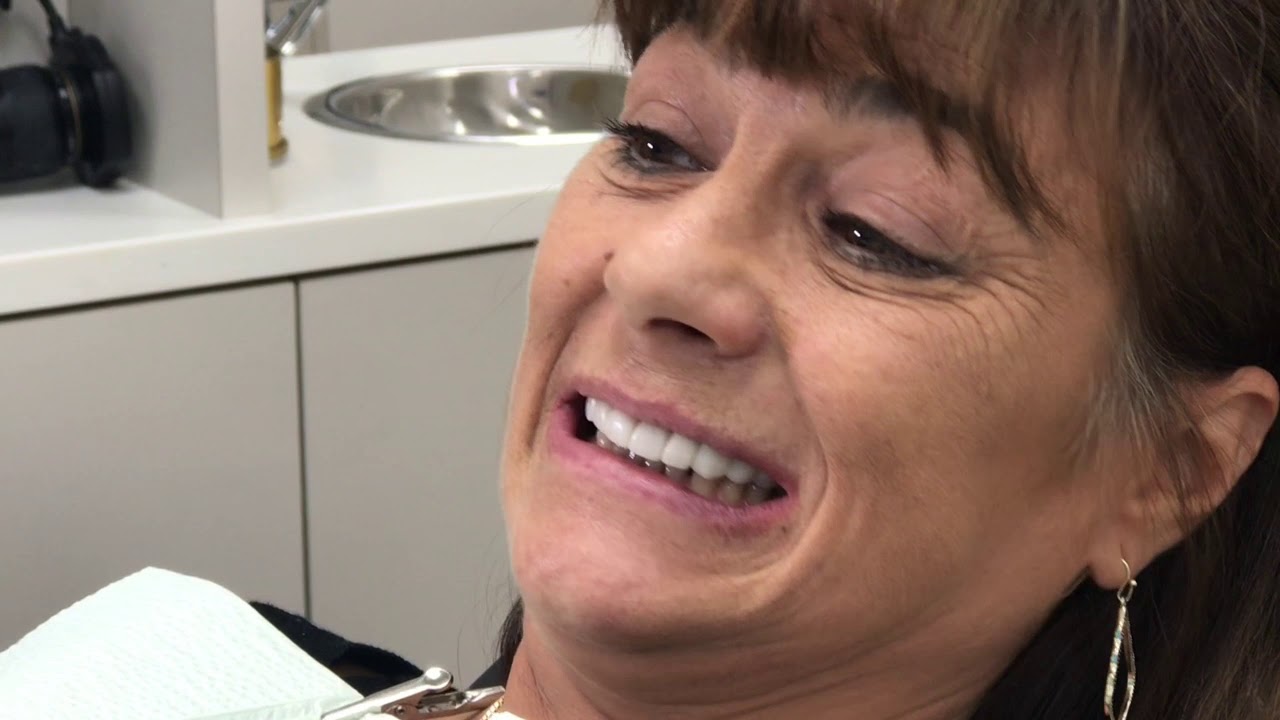 Houston Cosmetic Dentist: Two solutions in one with Snap-on Smile! Whiter teeth  and replacing teeth