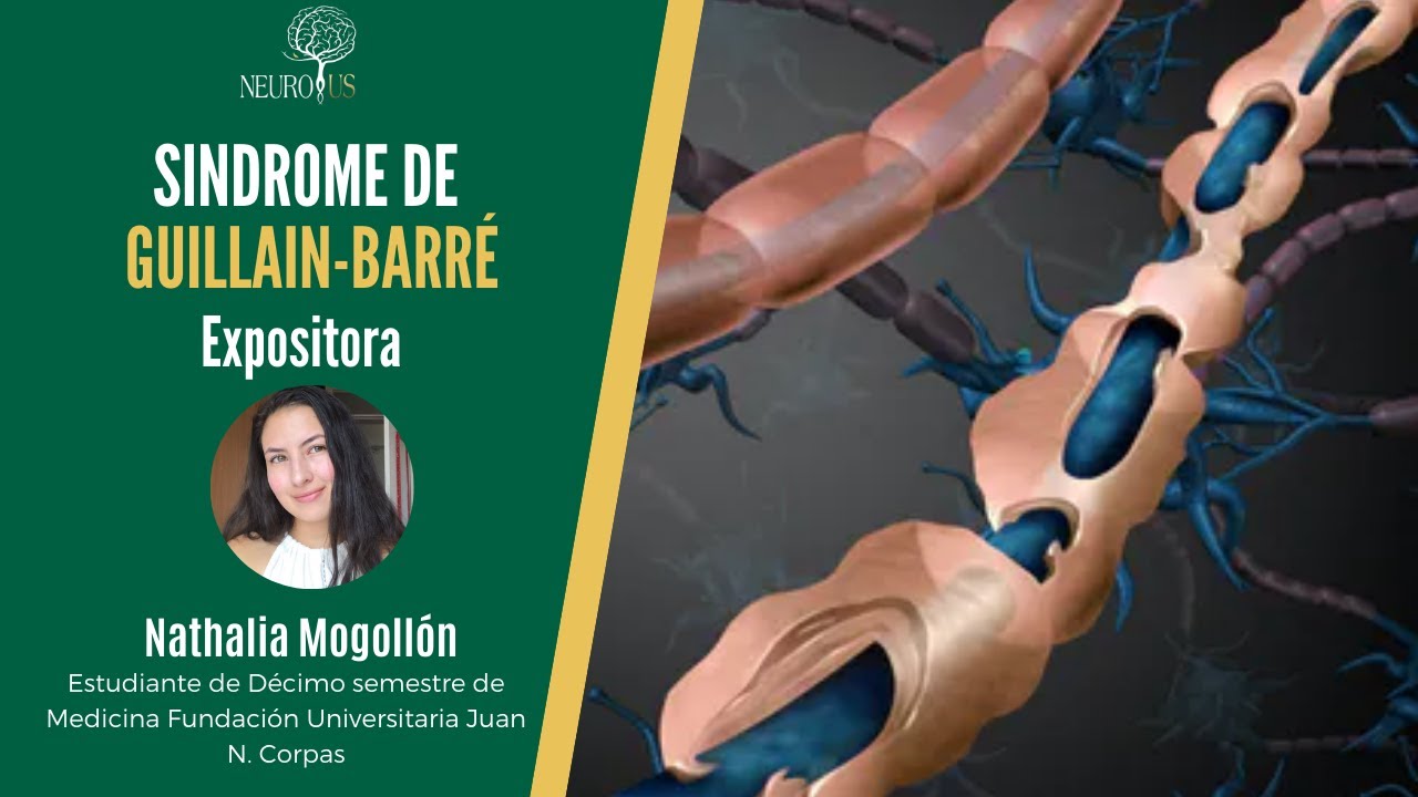 Síndrome de Guillain Barré