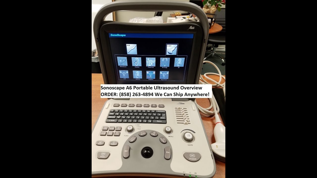 Sonoscape A6 Ultrasound Overview