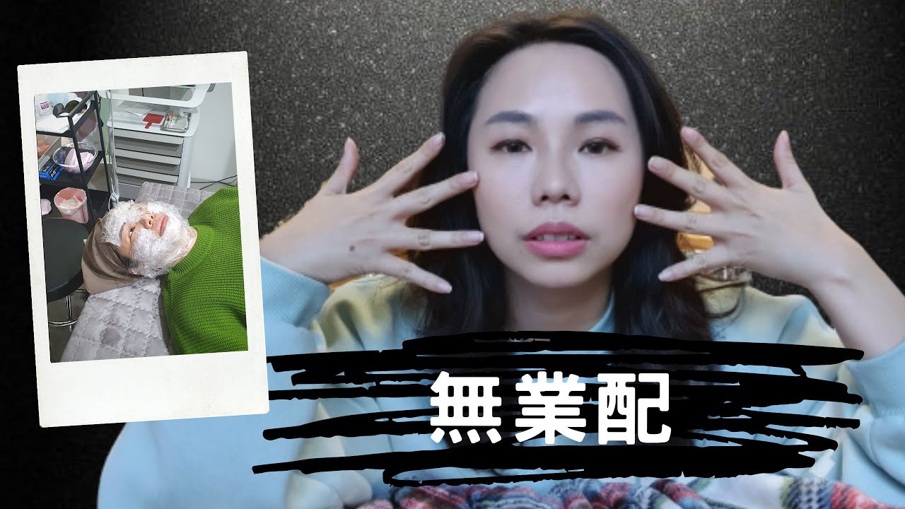 韓國醫美 ▍首爾自費打音波+電波+肉毒 18天記錄  打完第十天拍片時臉超僵🤣