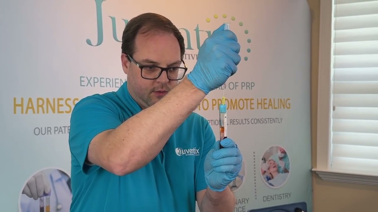 Precision PRP Extraction: A Comprehensive Step-by-Step Technique for Optimal Regenerative Results!
