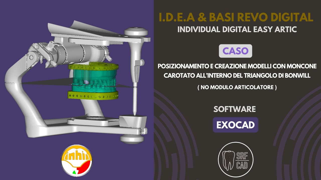 EXOCAD MODEL CREATOR  IDEA REVO DIGITAL TRIANGOLO DI BONWILL NO MODULO ARTICOLATORE MONCONE CAROTATO