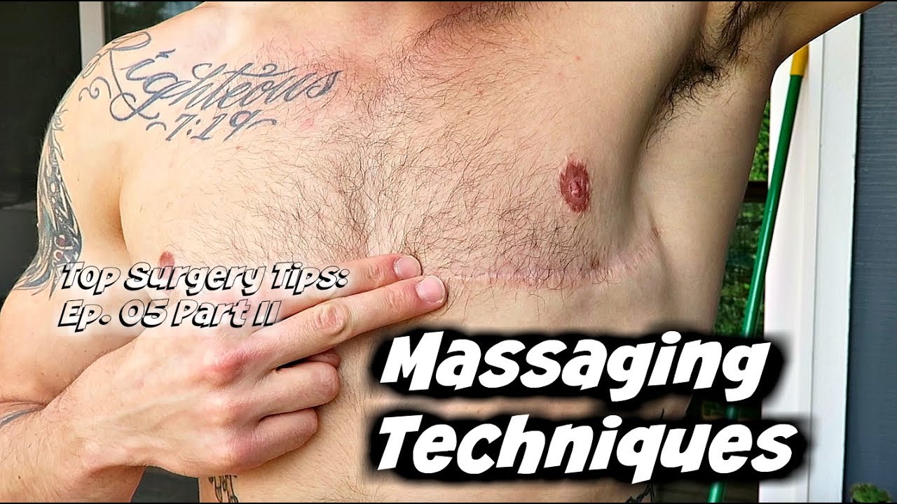 Top Surgery Tips Ep. 05: Part II- Scar Creams & Massage