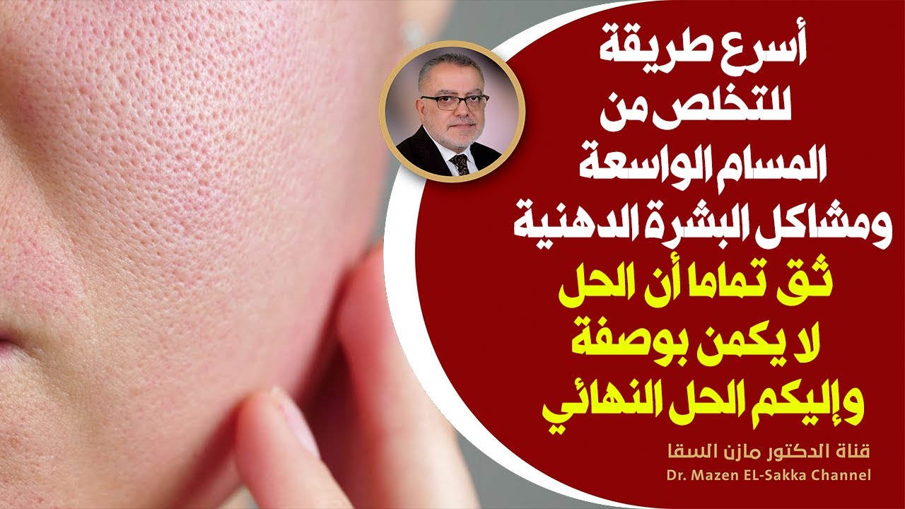 إذا أردتم اسرع طريقة للتخلص من المسام الواسعة والبشرة الدهنيةهنا الحل النهائي للتخلص من المسام واسعة