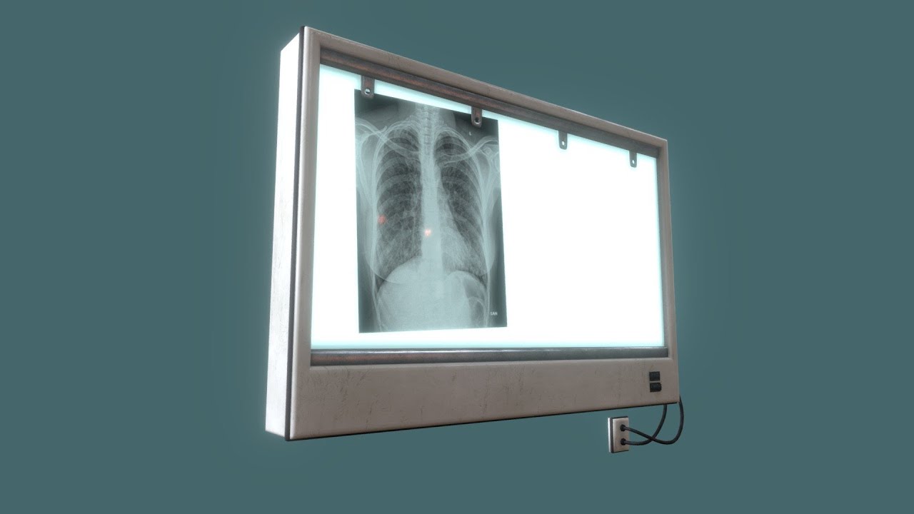 X-Ray Viewer &ndash; A Brief Guide
