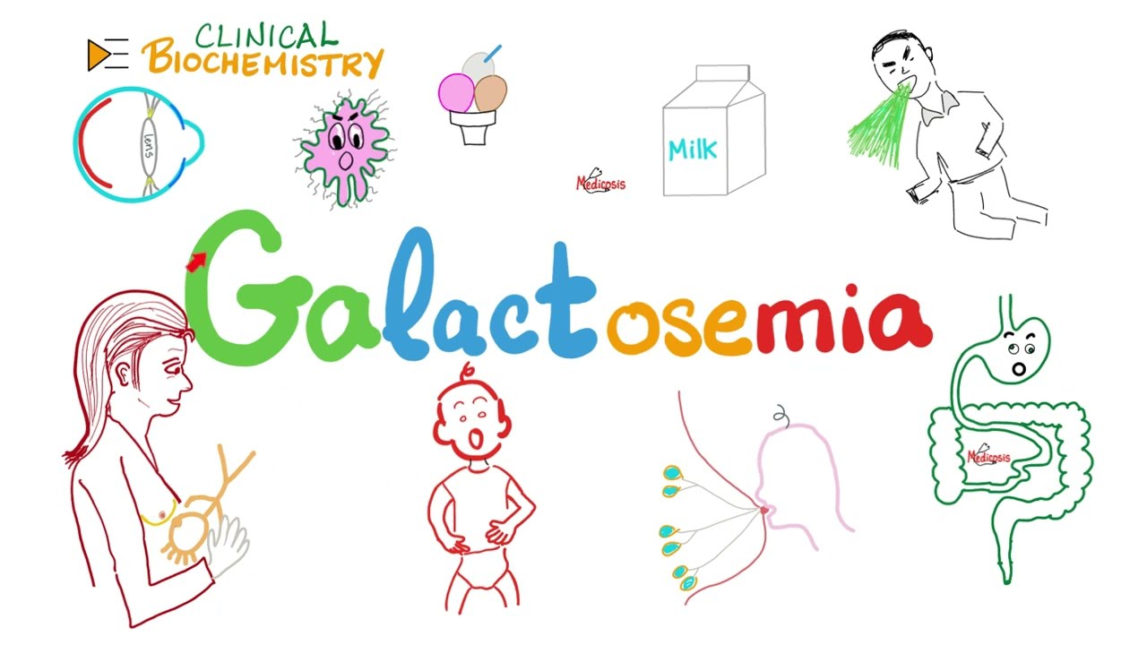 Galactosemia, Galactokinase deficiency, Lactose Intolerance - Lactose Metabolism Disorders - Biochem