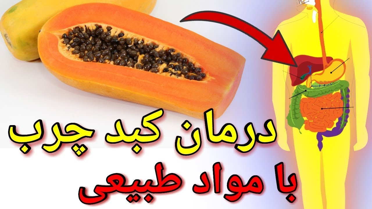 نوزده ۱۹ ماده طبیعی برای درمان کبد چرب