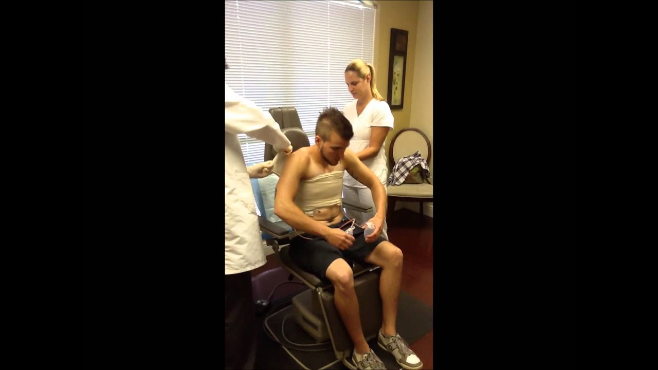 Top Surgery Compilation