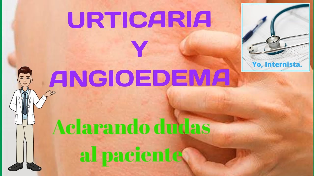 ALERGIAS: URTICARIA Y ANGIOEDEMA PARA EL PACIENTE