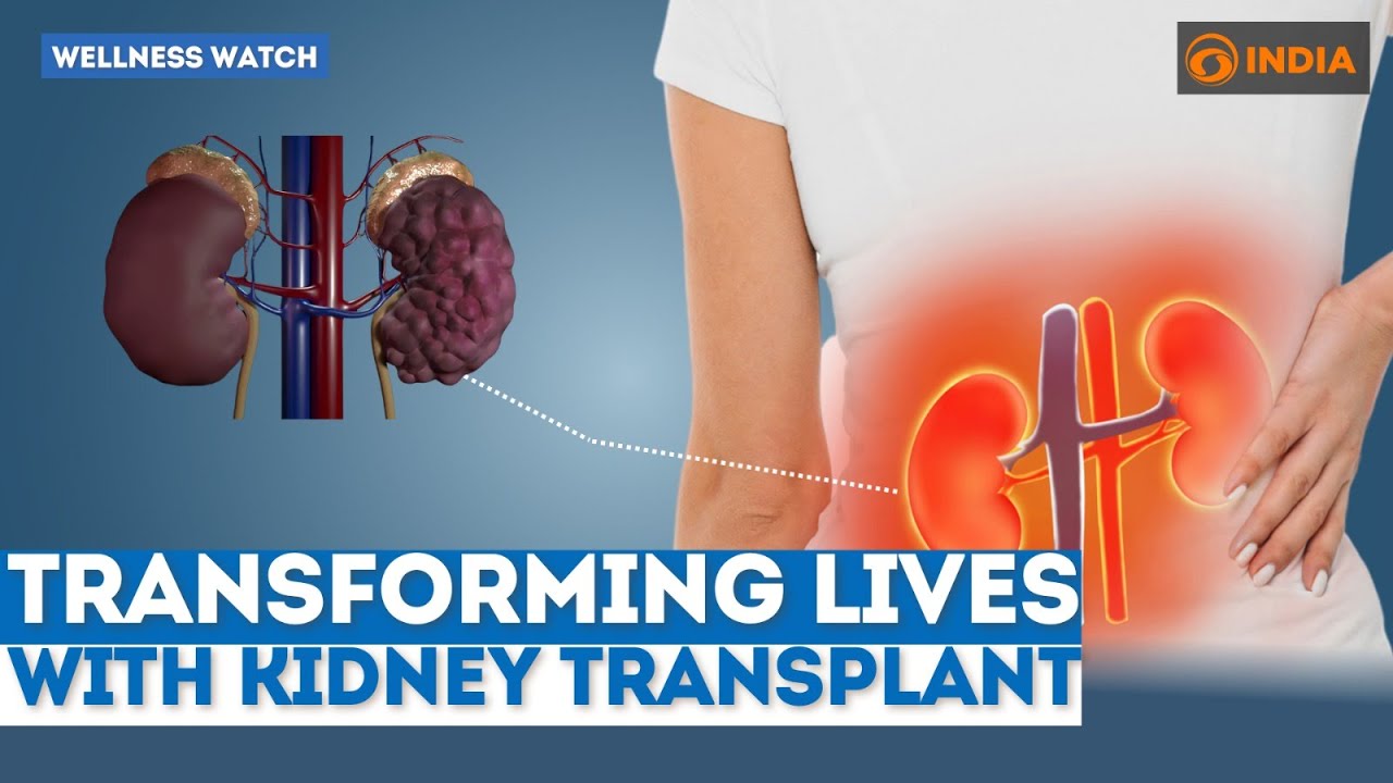 Transforming Lives With Kidney Transplant | Wellness Watch