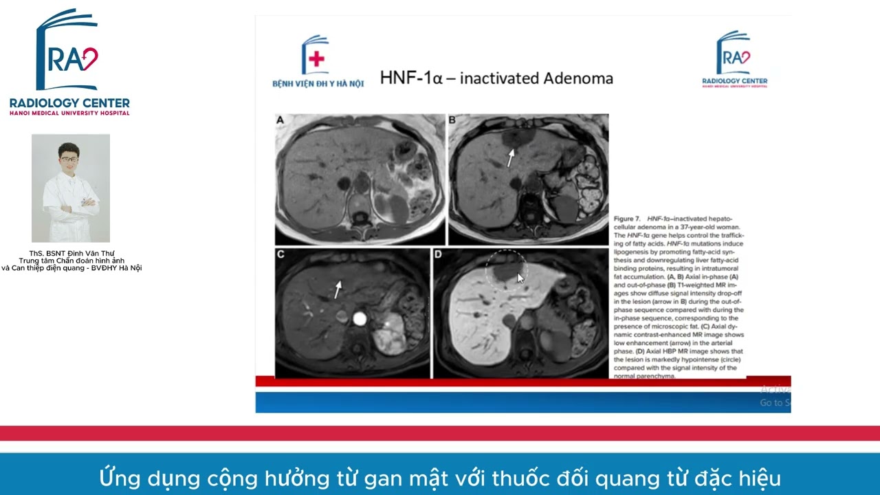 ỨNG DỤNG CỘNG HƯỞNG TỪ GAN MẬT VỚI THUỐC ĐỐI QUANG TỪ ĐẶC HIỆU