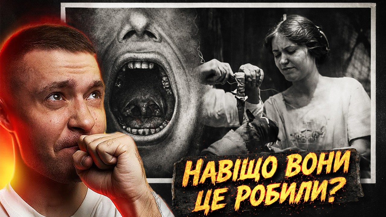 ЛІКАРІ ПОМИЛЯЮТЬСЯ: 3 реальні історії в які важко повірити