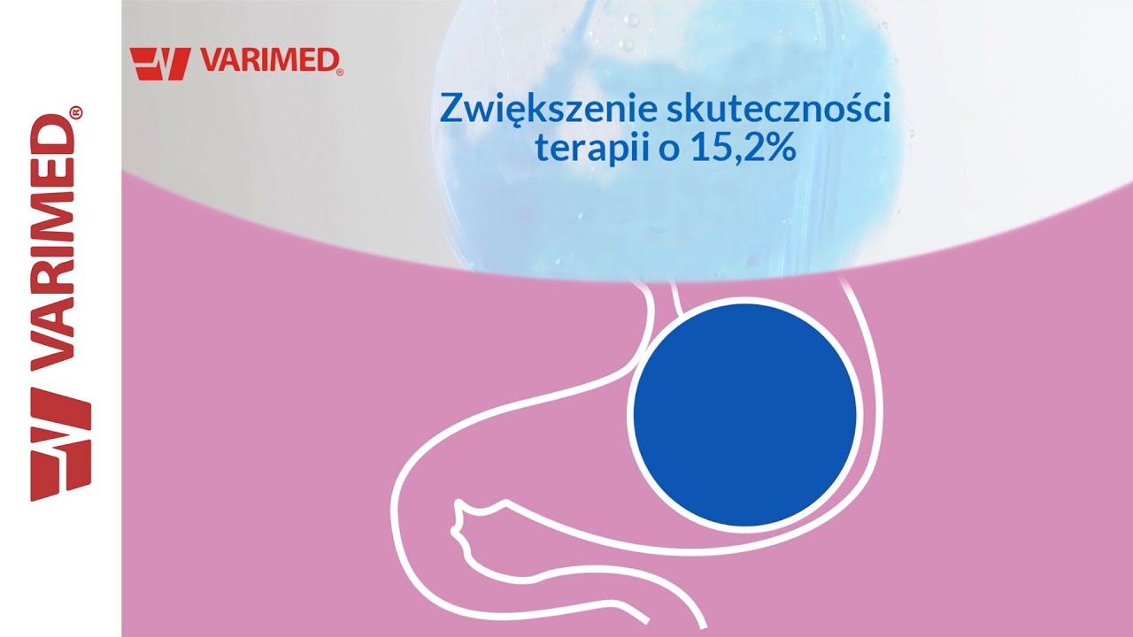 Varimed - balony żołądkowe - autoryzowany przedstawiciel Spatz