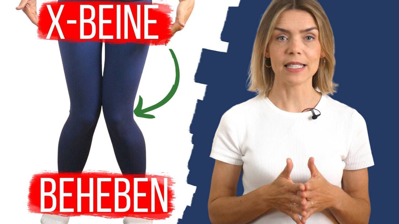 Was Schmerzen bei X-Beinen verursacht und wie du sie besserst