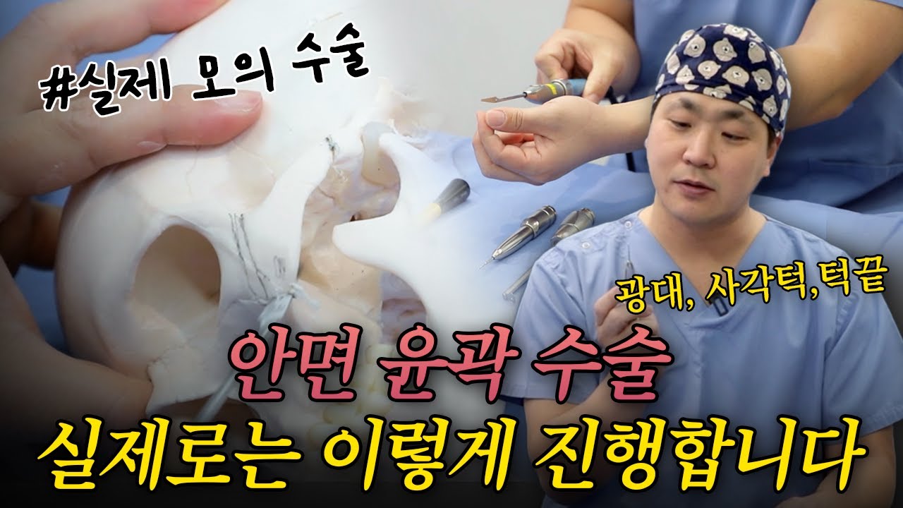 윤곽수술 실제로 이렇게 합니다 #안면윤곽 #모의수술