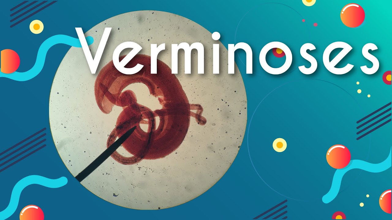 Verminoses: doen&ccedil;as causadas por vermes - Brasil Escola