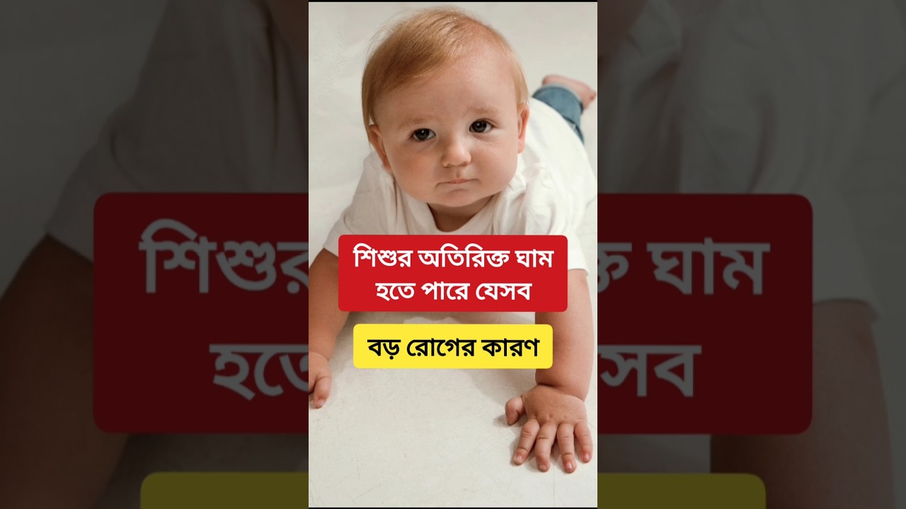 শিশুর অতিরিক্ত ঘাম হতে পারে যেসব বড় রোগের কারণ #parenting #babycare #childcare #healthtips #shorts