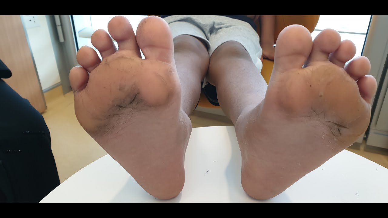 Toe Walkers, The Parents Guide
