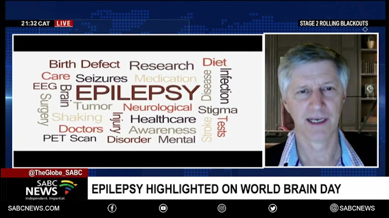 Epilepsy affects one in every 100 people in South Africa