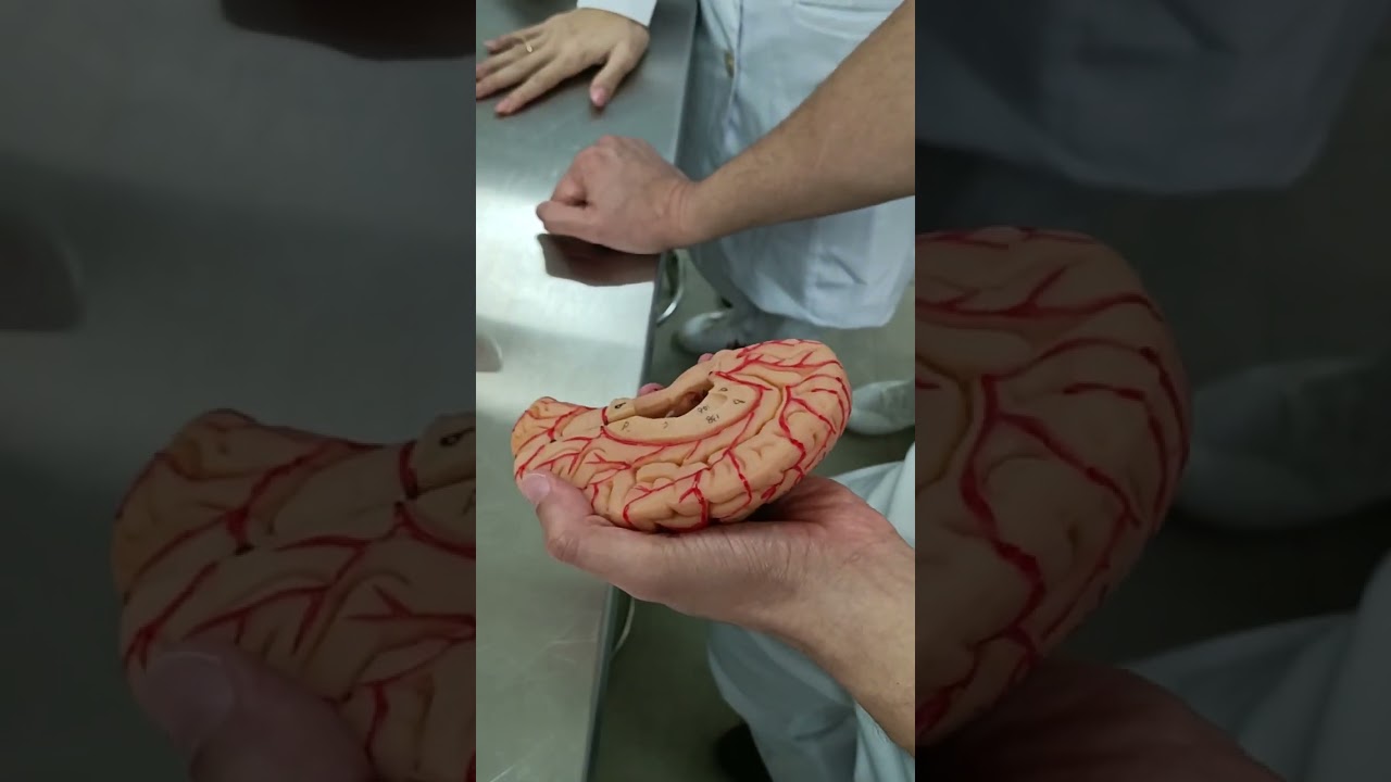 Prática Neuroanatomia N4 part 1