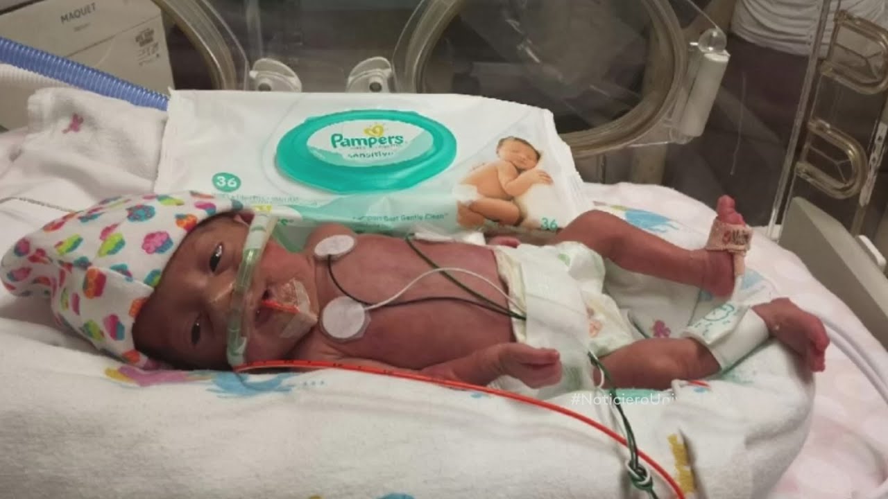 Beb&eacute; prematuro vive contra todo pron&oacute;stico