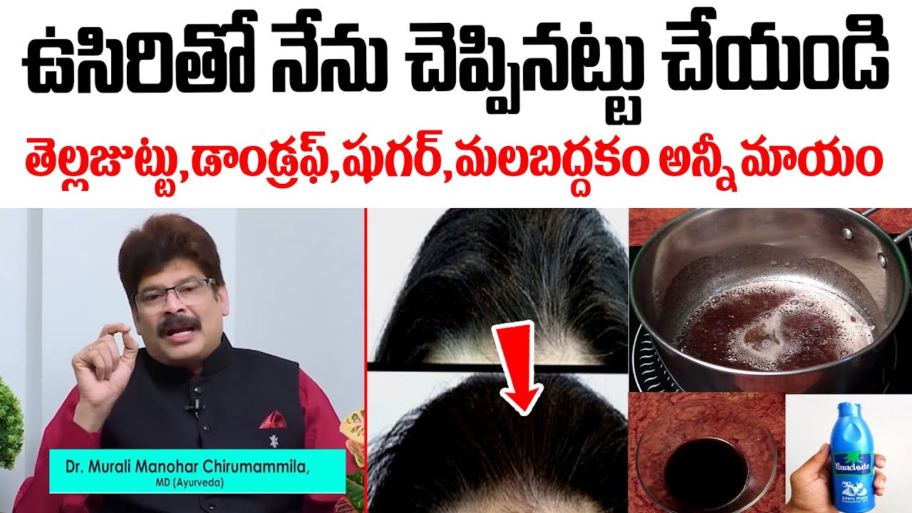 ఉసిరితో ఇలా చేస్తే తెల్లజుట్టు అనేది రాదు ఉన్నా నల్లబడుతుంది| White Hair To Black Hair | Hair Growth